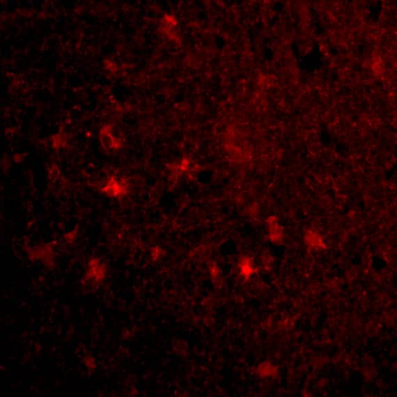 Immunocytochemistry/ Immunofluorescence: MAVS Antibody - BSA Free [NBP1-77275] - Immunofluorescence of MAVS in Human Brain cells with MAVS antibody at 20 u/mL.