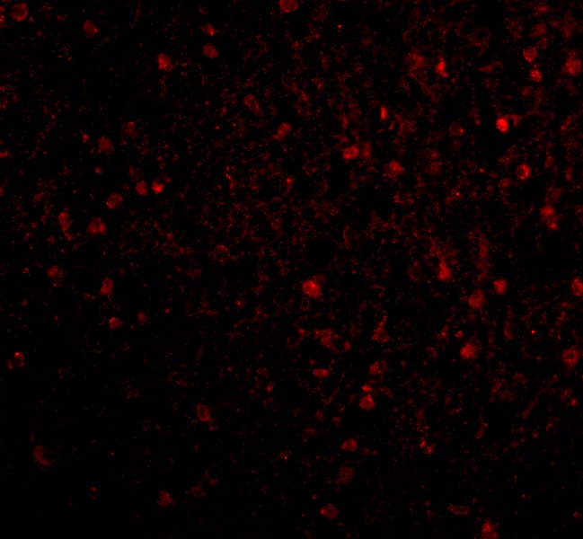 Immunocytochemistry/ Immunofluorescence BRSK2 Antibody - BSA Free