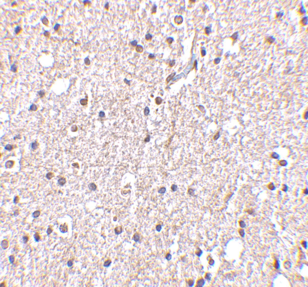 Immunohistochemistry BRSK2 Antibody - BSA Free