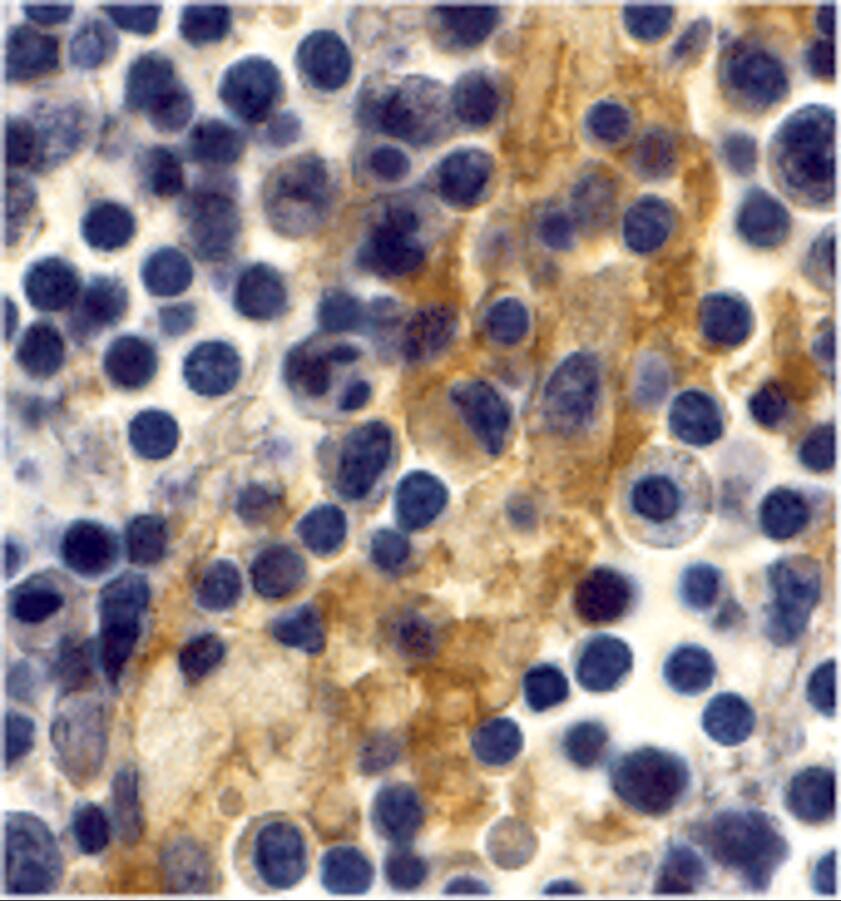 Immunohistochemistry: DC-SIGN/CD209 Antibody - BSA Free [NBP1-77284] - Immunohistochemistry of DC-SIGN/CD209 in human lymph node tissue with DC-SIGN/CD209 antibody at 10 u/mL.