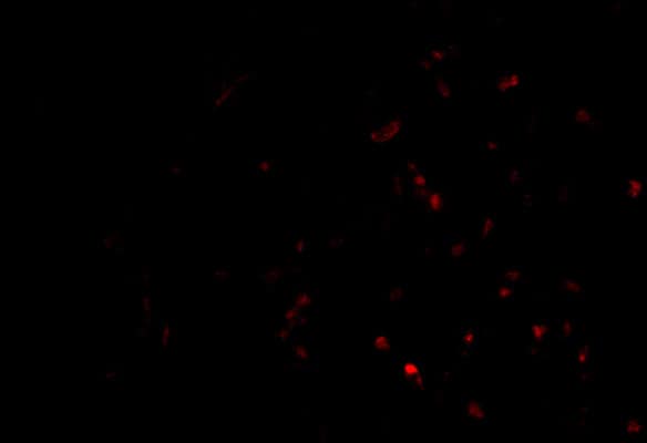 Immunocytochemistry/ Immunofluorescence: TEP1 Antibody - BSA Free [NBP1-77285] - Immunofluorescence of TP-1 in Human Lung cells with TP-1 antibody at 20 u/mL.