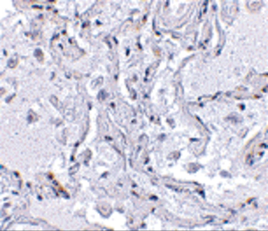 Immunohistochemistry: TEP1 Antibody - BSA Free [NBP1-77285] - Immunohistochemical staining of human lung tissue using TEP1 antibody at 2.5 u/mL.