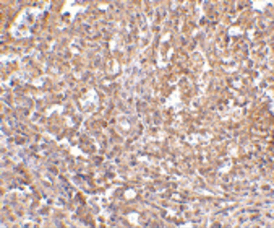 Immunohistochemistry: Orai1 Antibody - BSA Free [NBP1-77289] - Immunohistochemistry of Orai1 in human spleen tissue with Orai1 antibody at 2.5 u/mL.