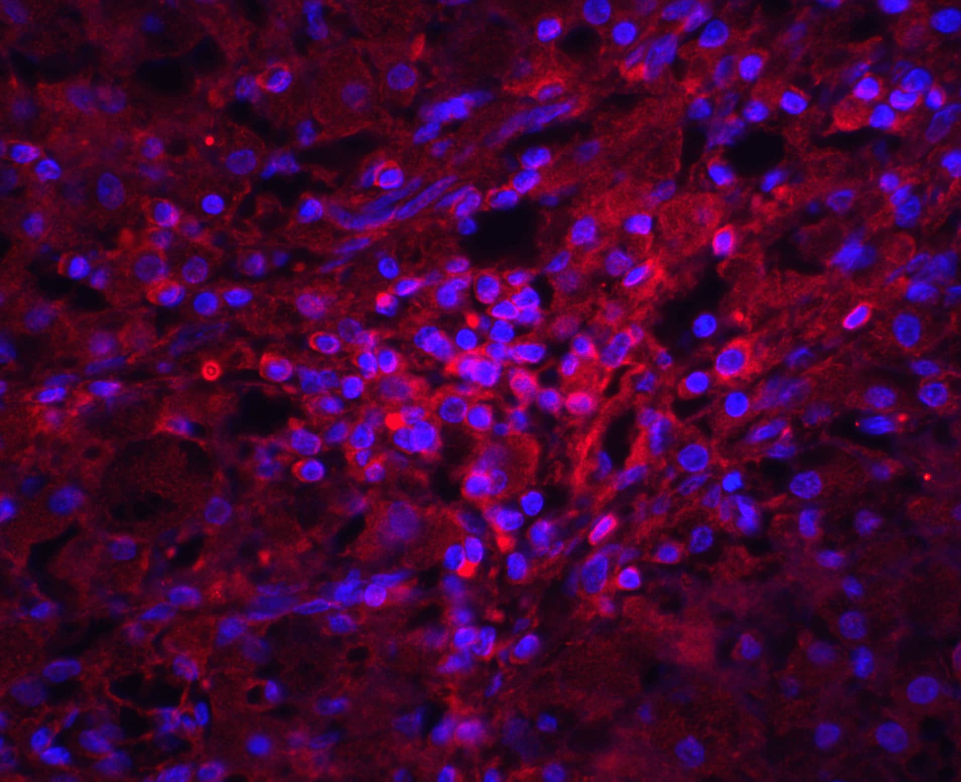 Immunocytochemistry/ Immunofluorescence: Orai1 Antibody - BSA Free [NBP1-77289] - Immunofluorescence of Orai1 in human ovary tissue with Orai1 antibody at 20 u/mL.Red: Orai1 Antibody   Blue: DAPI staining