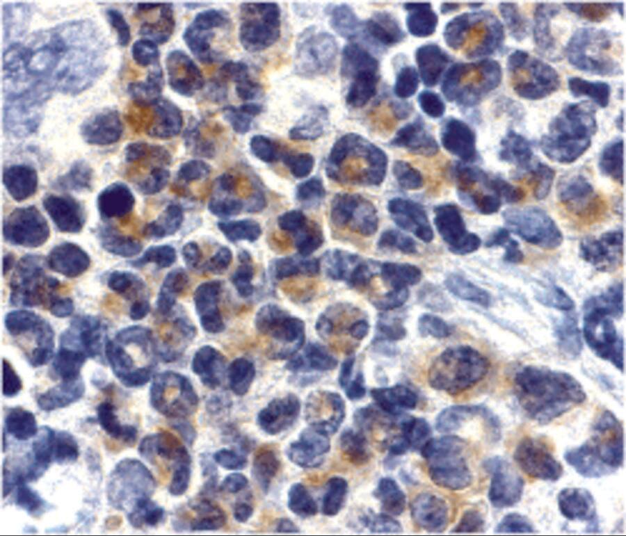 Immunohistochemistry: DAP Kinase 2 Antibody - BSA Free [NBP1-77291] - Immunohistochemistry of DAP Kinase 2 in mouse spleen cells with DAP Kinase 2 antibody at 2 ug/mL.