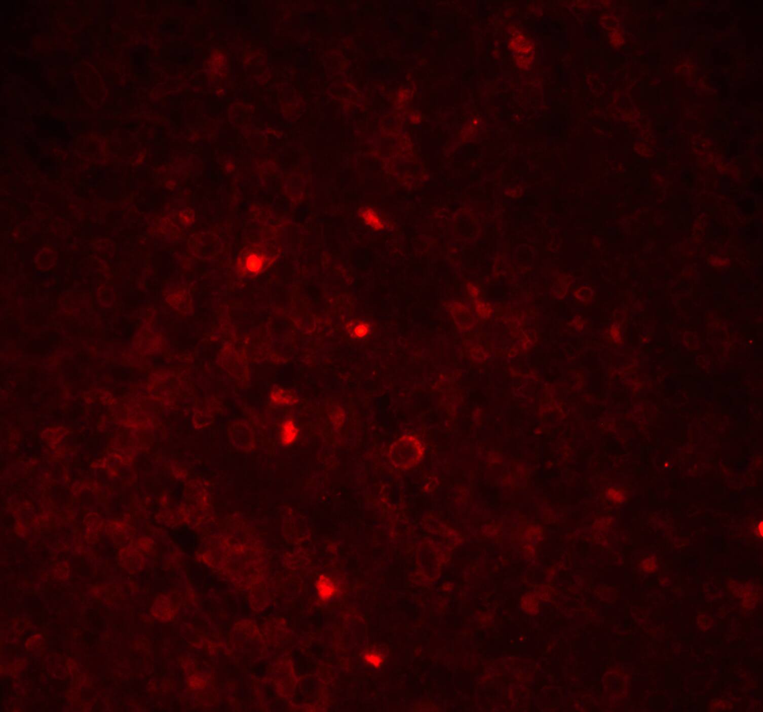 Immunohistochemistry: ASC/TMS1 Antibody - BSA Free [NBP1-77297] - Validation of ASC/TMS1 in Human Spleen Tissue. Immunofluorescent analysis of 4% paraformaldehyde-fixed Human Spleen Tissue labeling ASC/TMS1 with  at 20 ug/mL, followed by goat anti-rabbit IgG secondary antibody at 1/500 dilution (red). 