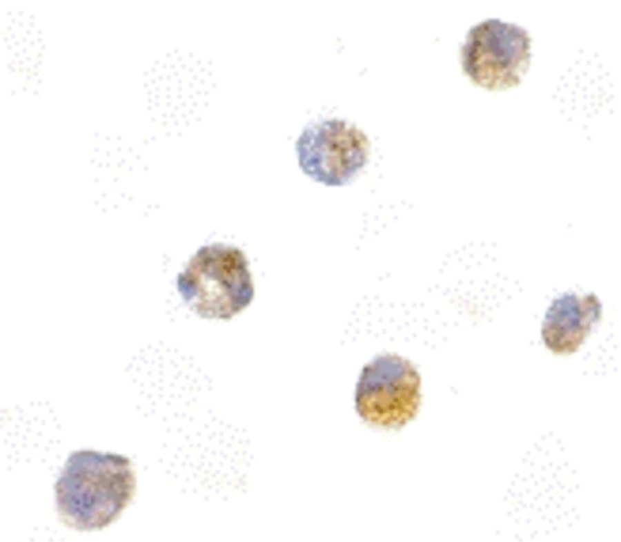 Immunocytochemistry/ Immunofluorescence: ASC/TMS1 Antibody - BSA Free [NBP1-77297] - Validation of ASC/TMS1 in HL60 Cells. Immunocytochemical analysis of HL60 cells using anti-ASC/TMS1 antibody  at 5 ug/ml. Cells was fixed with formaldehyde and blocked with 10% serum for 1 h at RT; antigen retrieval was by heat mediation with a citrate buffer (pH6). Samples were incubated with primary antibody overnight at 4C. A goat anti-rabbit IgG H&L (HRP) at 1/250 was used as secondary. Counter stained with Hematoxylin.