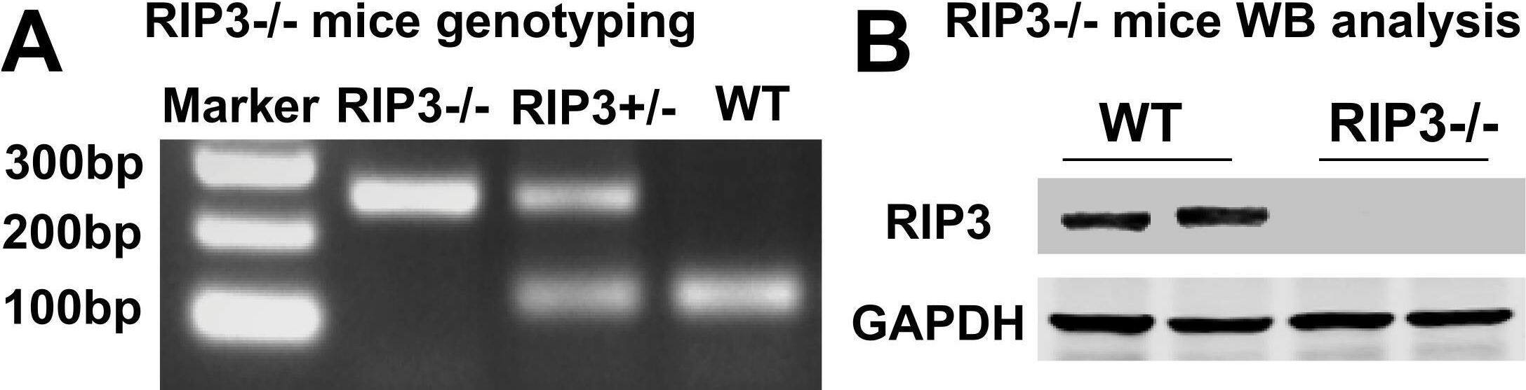 Western Blot: RIPK3/RIP3 Antibody - BSA Free [NBP1-77299] - Bone-marrow-derived macrophages exhibit significant reduction in RIPK3 levels in Ripk3 delta Global, Ripk3 delta MΦ-Cre & Ripk3 delta EC-Cre mice. (A,B) BMDMs were isolated, differentiated on chamber slides for 7 days, immunostained for macrophage markers CD68 (red; A) & CD11b (pink; B), & co-stained for nuclei (Hoechst; blue). All cells from seven separate BMDM isolations were positive for these markers (n=7). (C) A phagocytosis assay was performed on BMDMs with fluorescent polystyrene beads. Phagocytic cells display TRITC+/Hoechst+ signal, & 85% of cells from two separate BMDM isolations were double positive (n=2). (D-F) Protein or RNA was collected from control, Ripk3 delta Global, Ripk3 delta MΦ-Cre & Ripk3 delta EC-Cre BMDMs. RNA was converted to cDNA & analyzed by qPCR for Ripk3 levels (D). Protein lysates were immunoblotted to identify CD11b, RIPK3 &  beta -actin (loading control) (E) & quantified (F). (G) RNA from control & Ripk3 delta Global BMDMs was converted to cDNA & analyzed by qPCR for Ripk3-Exon 10 levels. For panels D,F,G, each dot represents a BMDM isolation from an individual animal. Statistics for panels D & F were calculated using one-way ANOVA with Dunnett's multiple comparisons test. Overall ANOVA P-values (prior to the post hoc tests) are 0.0002 (D) & 76%. Values are expressed as means +/- SEM; * p 76%. Values are expressed as means +/- SEM; * p < 0.05 versus WT group; #p < 0.05 versus WT-I/R group, (n = 6/group). (D) Graph showing increases in the levels of serum creatine in WT mice after renal I/R compared to sham-operated animals. However, in RIP3−/− mice, the level of serum creatine was reduced when compared to littermate WT mice after renal I/R. Note that there was no difference in the levels of serum creatine between WT and RIP3−/− sham mice. Values are expressed as means +/- SEM; * p < 0.05 versus WT-Sham group, respectively; #p < 0.05 versus WT-I/R group (n = 6/group). Image collected and cropped by CiteAb from the following open publication (//pubmed.ncbi.nlm.nih.gov/35741025), licensed under a CC-BY license. Not internally tested by Novus Biologicals.
