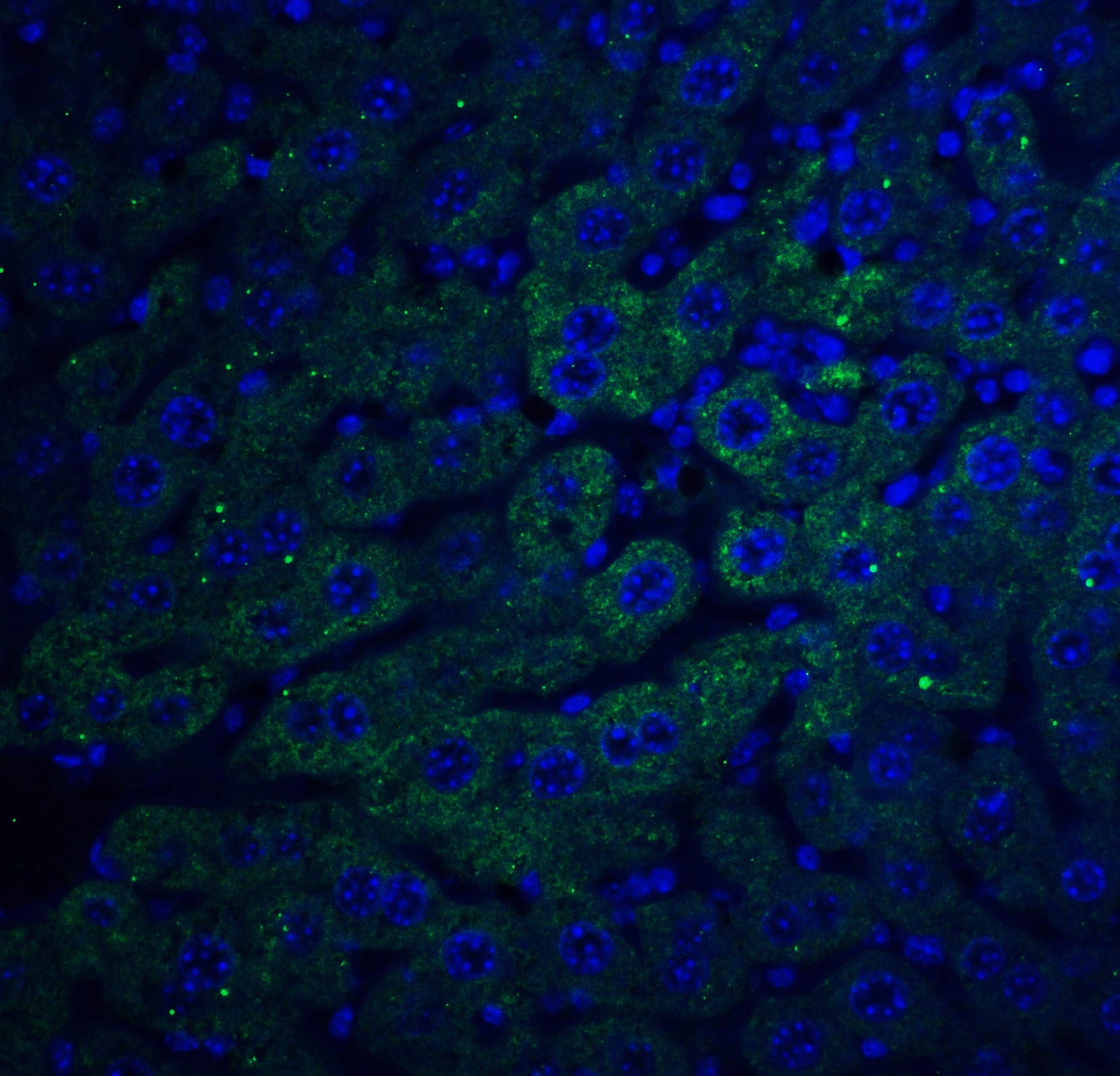 Immunocytochemistry/ Immunofluorescence FEM1B Antibody - BSA Free