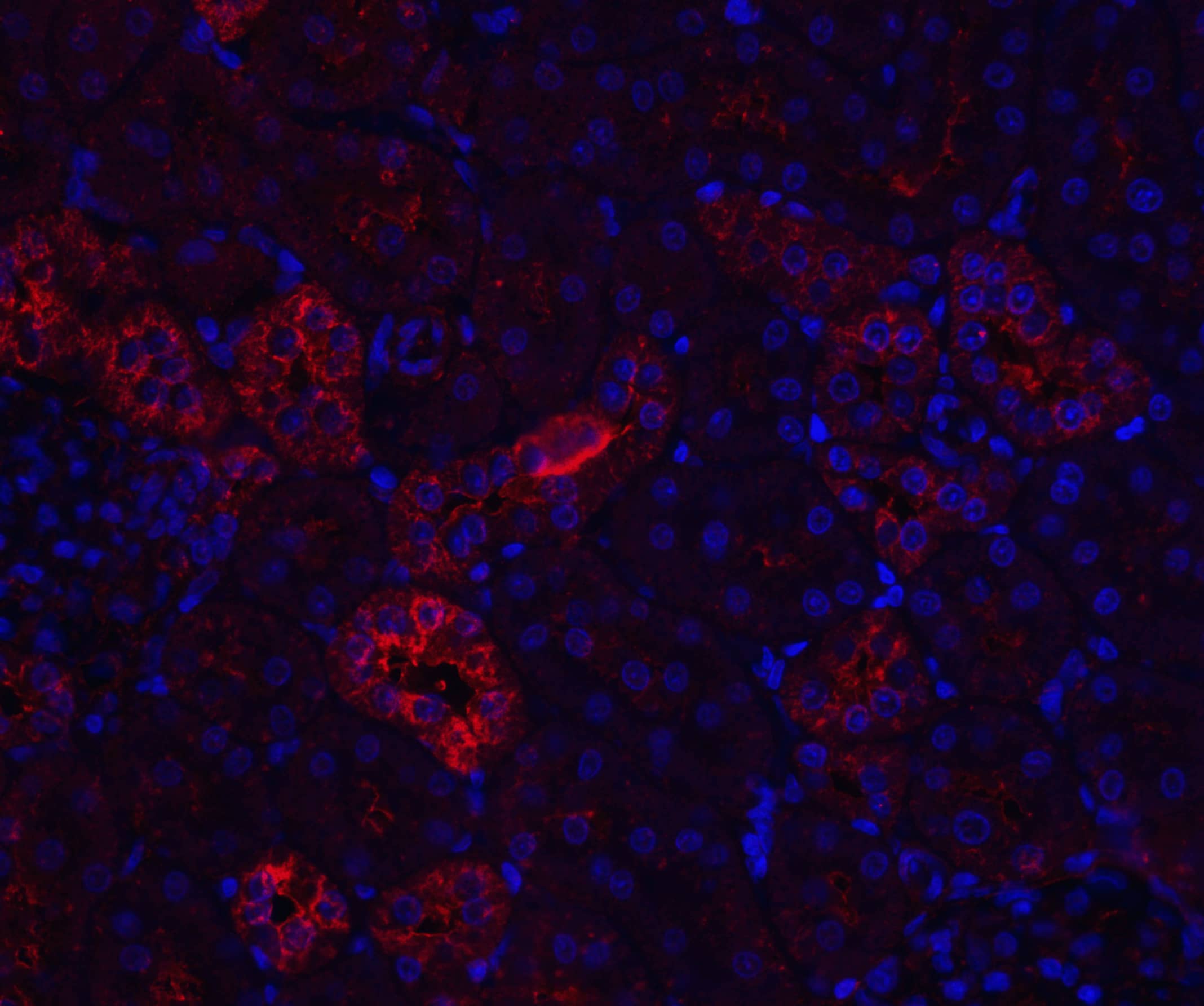 Western Blot: Nephrin Antibody - BSA Free [NBP1-77303] - Nephrin Antibody [NBP1-77303] - In vitro AS-IV effects on SIRT1 and NF-kB p65 expression in hyperglycaemia-triggered podocyte EMT.Podocytes were pretreated with high glucose for 1hour, and then incubated with PDTC or AS-IV for 48hours. The levels of TGF-, nephrin, E-cadherin, N-cadherin and -SMA were quantified with Western blotting. Data is presented as meanSD. n=3. *Compared with normal glucose cohort, or high glucose plus AS-IV cohort, or high glucose plus PDTC cohort, P Figure 6 Immunofluorescence Validation of Nephrin in Rat Kidney TissueImmunofluorescent analysis of 4% paraformaldehyde-fixed rat kidney tissue labeling Nephrin with  at 20 u/mL, followed by goat anti-rabbit IgG secondary antibody at 1/500 dilution (red) and DAPI staining (blue). 