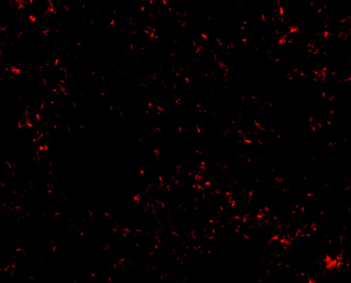 Immunocytochemistry/ Immunofluorescence SnoN Antibody - BSA Free