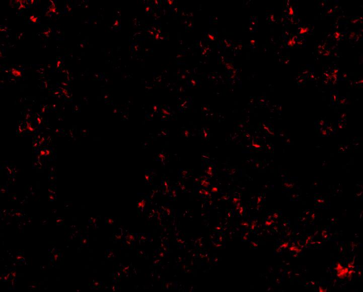 Immunocytochemistry/ Immunofluorescence SnoN Antibody - BSA Free