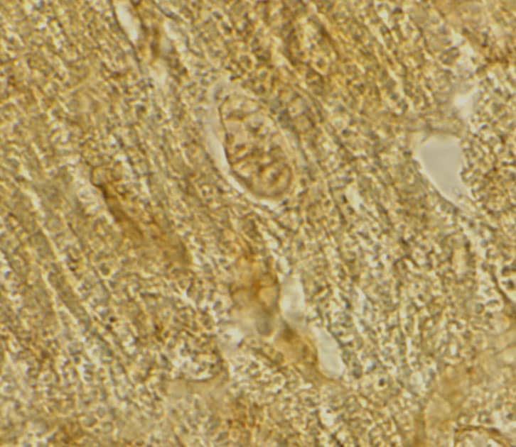 Immunohistochemistry: BACE-2 Antibody - BSA Free [NBP1-77308] - Immunohistochemistry of BACE-2 in rat heart tissue with BACE-2 antibody at 2 u/mL.