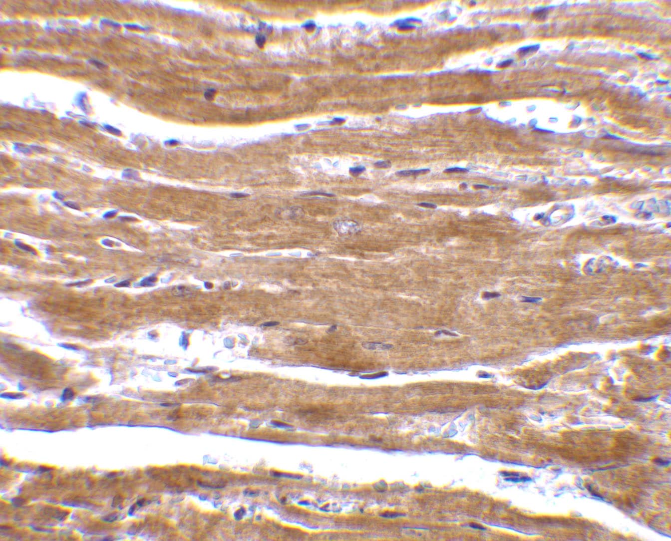 Immunohistochemistry: BACE-2 Antibody - BSA Free [NBP1-77309] - Immunohistochemistry of BACE-2 in mouse heart with BACE-2 antibody at 10 ug/mL.