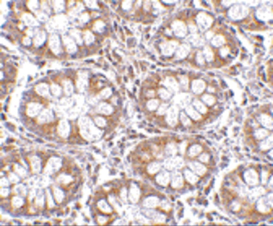 Immunohistochemistry: Endosialin/CD248/TEM1 Antibody - BSA Free [NBP1-77310] - Validation of TEM-1 in Human Colon Tissue.  Immunohistochemical analysis of paraffin-embedded Human Colon tissue using anti-TEM-1 antibody  at 2.5 ug/ml. Tissue was fixed with formaldehyde and blocked with 10% serum for 1 h at RT; antigen retrieval was by heat mediation with a citrate buffer (pH6). Samples were incubated with primary antibody overnight at 4C. A goat anti-rabbit IgG H&L (HRP) at 1/250 was used as secondary. Counter stained with Hematoxylin.