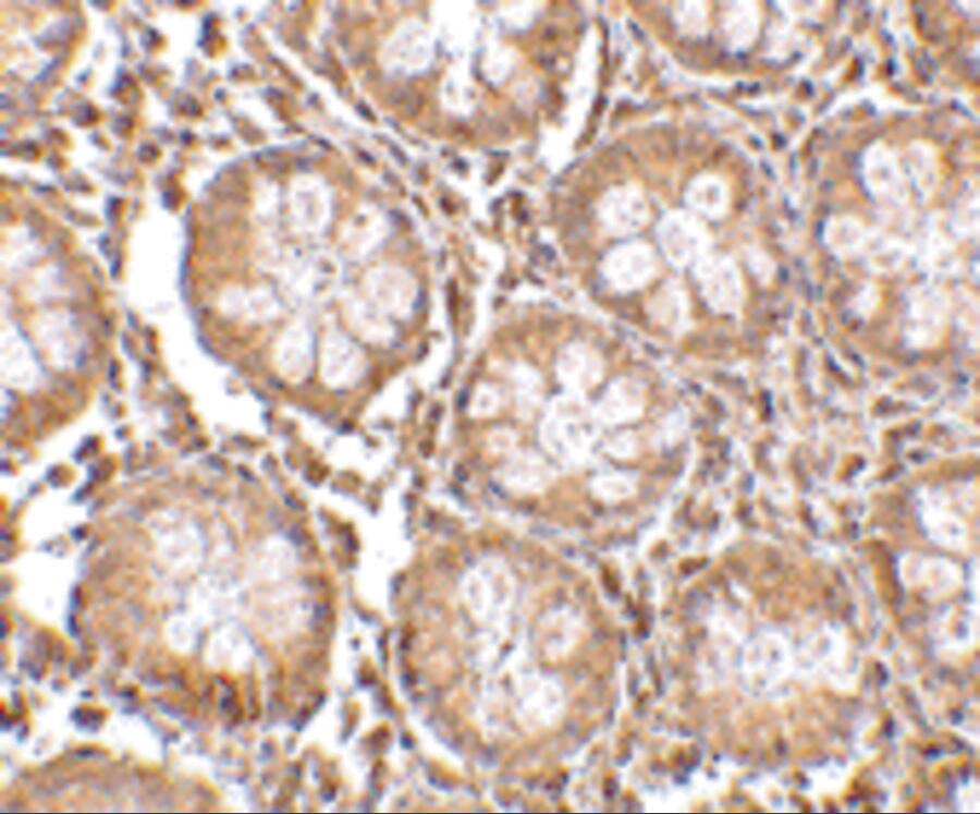 Immunohistochemistry: Endosialin/CD248/TEM1 Antibody - BSA Free [NBP1-77311] - Figure 4 Immunohistochemistry Validation of TEM-1 in Human Colon Tissue  Immunohistochemical analysis of paraffin-embedded Human Colon tissue using anti-TEM-1 antibody  at 2.5 u/ml. Tissue was fixed with formaldehyde and blocked with 10% serum for 1 h at RT; antigen retrieval was by heat mediation with a citrate buffer (pH6). Samples were incubated with primary antibody overnight at 4C. A goat anti-rabbit IgG H&L (HRP) at 1/250 was used as secondary. Counter stained with Hematoxylin.