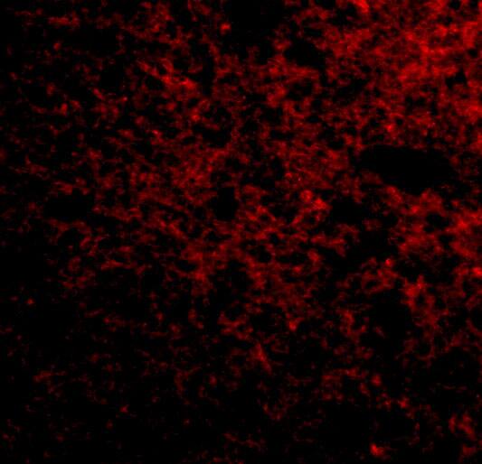 Immunocytochemistry/ Immunofluorescence: SP110 Antibody - BSA Free [NBP1-77316] - Immunofluorescence of SP110 in Human Brain cells with SP110 antibody at 50 u/mL.