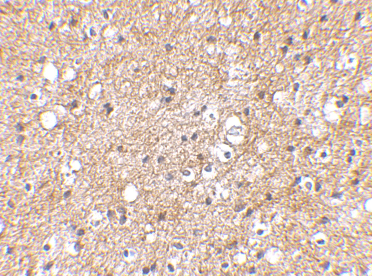 Immunohistochemistry: SP110 Antibody - BSA Free [NBP1-77316] - Immunohistochemical staining of human brain tissue using SP110 antibody at 2.5 ug/mL.