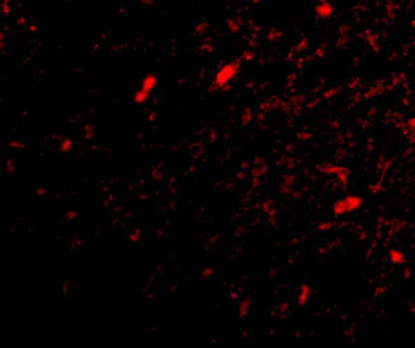 Immunocytochemistry/ Immunofluorescence FBXL20 Antibody - BSA Free