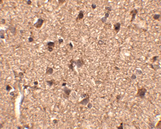 Immunohistochemistry: SLITRK1 Antibody - BSA Free [NBP1-77319] - Immunohistochemistry of SLITRK1 in human brain tissue with SLITRK1 antibody at 2.5 ug/mL. 