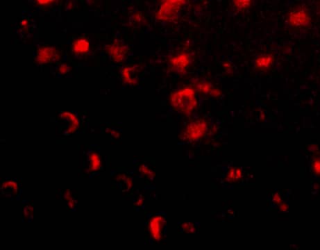 Immunohistochemistry: SLITRK1 Antibody - BSA Free [NBP1-77319] - Immunofluorescence of slitrk1 in human brain tissue with slitrk1 antibody at 20 ug/mL.