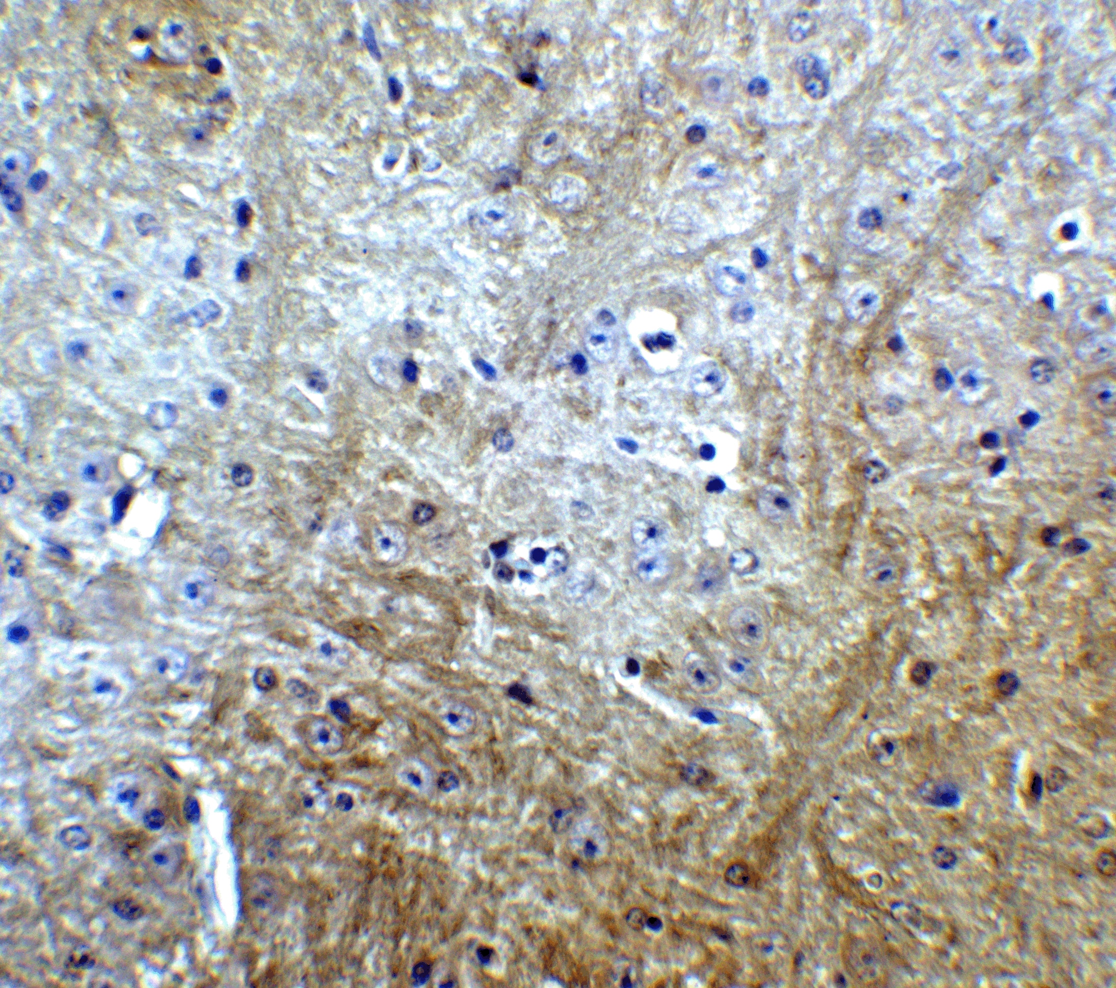 Immunohistochemistry: SLITRK1 Antibody - BSA Free [NBP1-77319] - Immunohistochemistry of SLITRK1 in mouse brain tissue with SLITRK1 Antibody at 5 ug/mL.