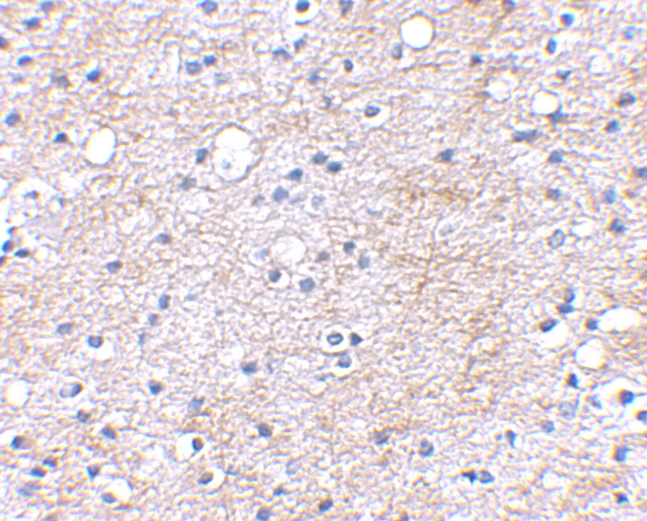 Immunohistochemistry: Lgi1 Antibody - BSA Free [NBP1-77320] - Immunohistochemical staining of human brain tissue using Lgi1 antibody at 2.5 u/mL.