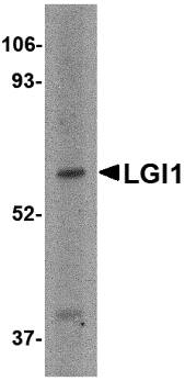 Western Blot: Lgi1 Antibody - BSA Free [NBP1-77320] - Western blot analysis of Lgi1 in HeLa cell lysate with Lgi1 antibody at 2 u/mL.