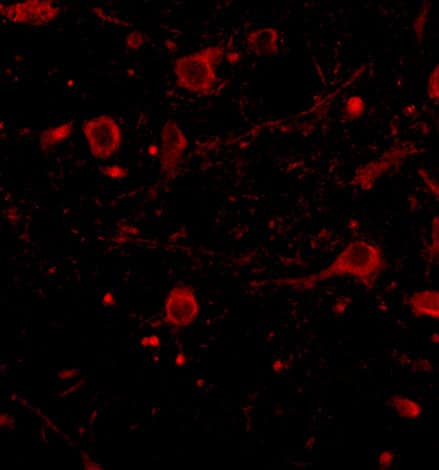 Immunocytochemistry/ Immunofluorescence: CADPS Antibody - BSA Free [NBP1-77323] - Immunofluorescence of CADPS in human brain tissue with CADPS antibody at 20 u/mL.