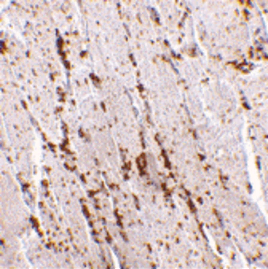 Immunohistochemistry: LIMPII/SR-B2 Antibody - BSA Free [NBP1-77326] - Immunohistochemistry of LIMPII/SR-B2 in human skeletal muscle tissue with LIMPII/SR-B2 antibody at 2.5 u/mL.