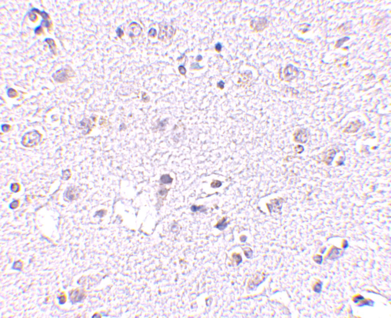 Immunohistochemistry: Lass5 Antibody - BSA Free [NBP1-77329] - Immunohistochemistry of Lass5 in human brain tissue with Lass5 antibody at 2.5 u/mL.