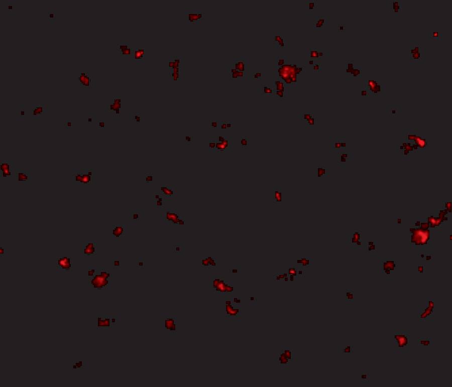 Immunocytochemistry/ Immunofluorescence: AAK1 Antibody - BSA Free [NBP1-77335] - Immunofluorescence of aak1 in human brain tissue with aak1 antibody at 20 u/mL.