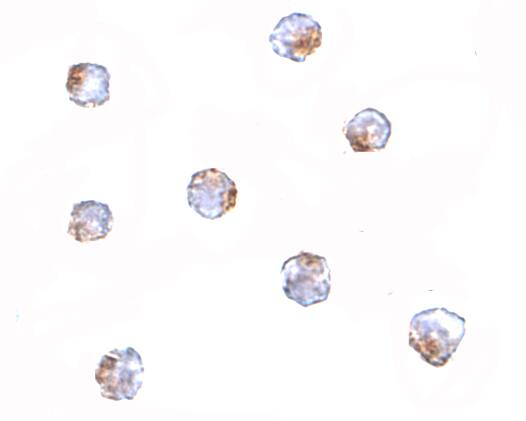 Immunocytochemistry/ Immunofluorescence: AAK1 Antibody - BSA Free [NBP1-77335] - Immunocytochemistry of AAK1 in A-20 cells with AAK1 antibody at 5 u/mL.