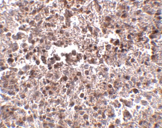 Immunohistochemistry: METTL7B Antibody - BSA Free [NBP1-77337] - Immunohistochemistry of METTL7B in human spleen tissue with METTL7B antibody at 2.5 ug/mL.