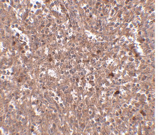 Immunohistochemistry: PIGY Antibody - BSA Free [NBP1-77340] - Immunohistochemistry of PIGY in human spleen tissue with PIGY antibody at 2.5 ug/mL.