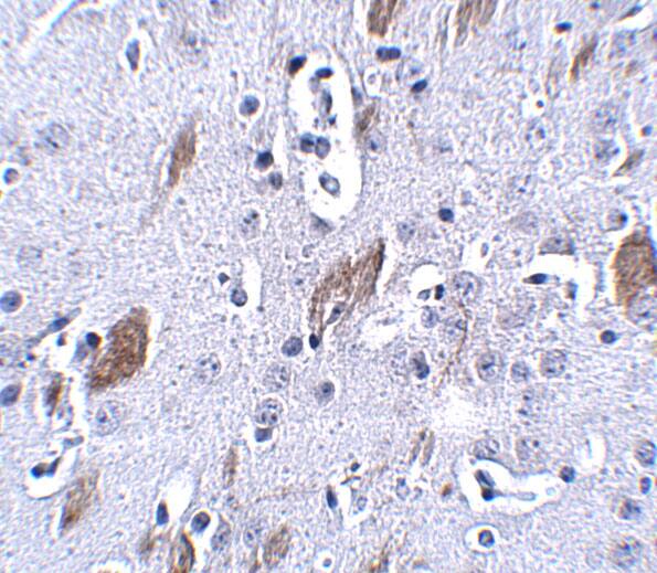 Immunohistochemistry ATOH8 Antibody - BSA Free