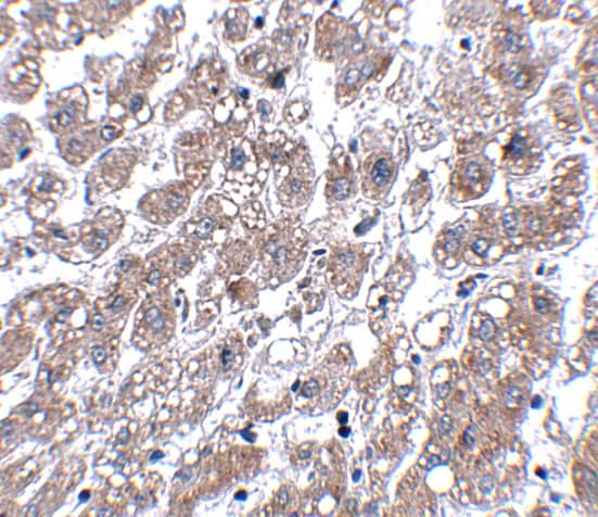 Immunohistochemistry Matrilin-1 Antibody - BSA Free