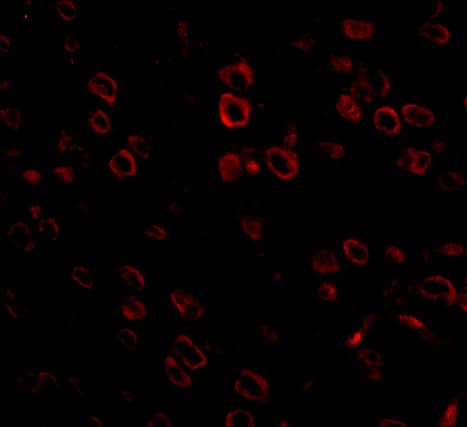 Immunocytochemistry/ Immunofluorescence FKBP15 Antibody - BSA Free