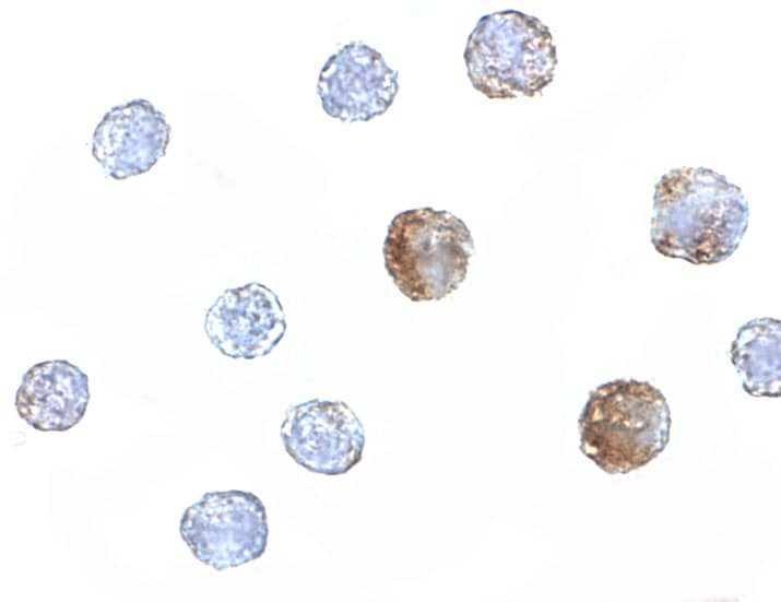 Immunocytochemistry/ Immunofluorescence: ST3GAL6 Antibody - BSA Free [NBP1-77353] - Immunocytochemistry of ST3GAL6 in HeLa cells with ST3GAL6 antibody at 5 ug/mL.