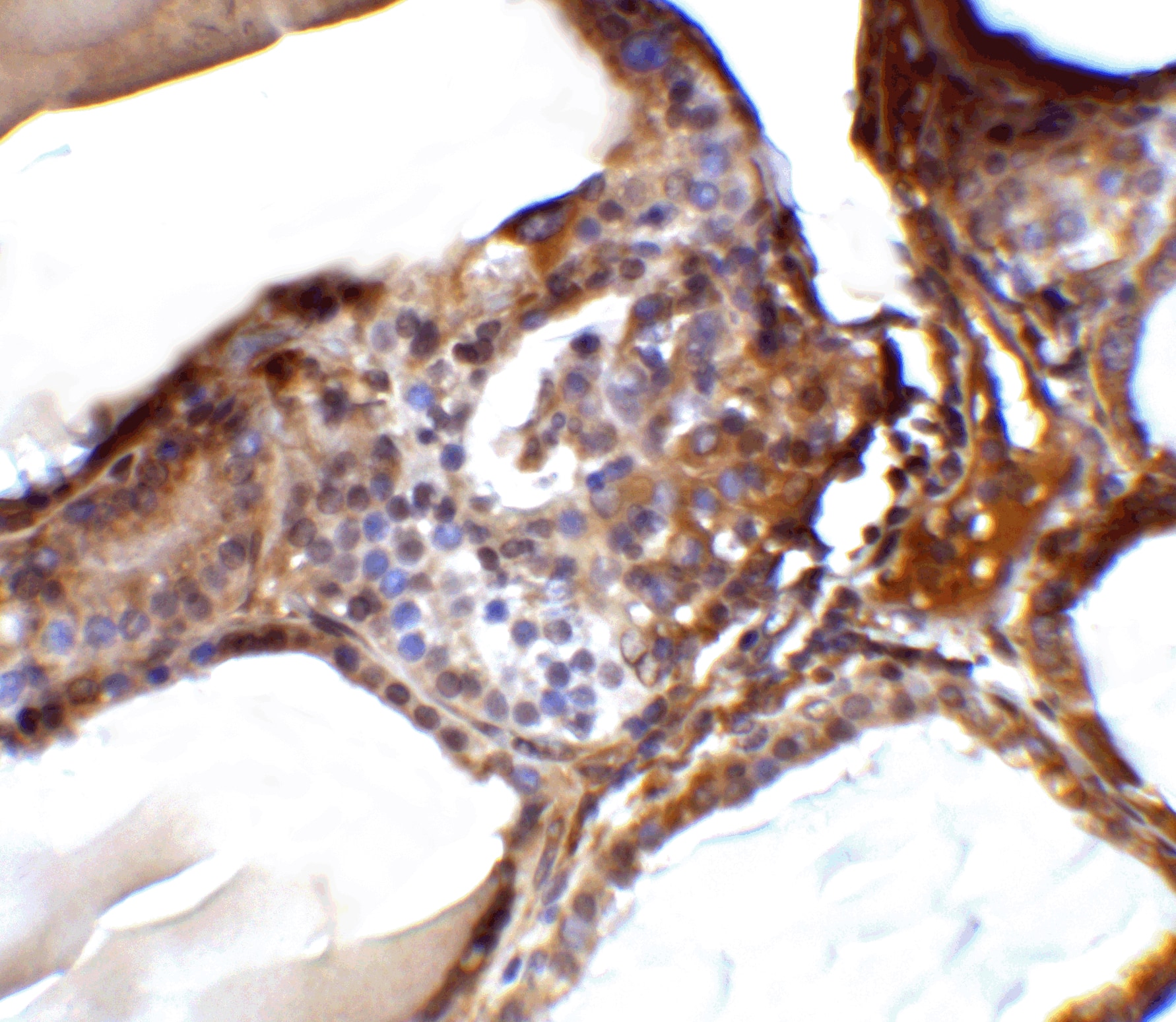 Immunohistochemistry: R-Spondin 1 Antibody - BSA Free [NBP1-77354] - Validation of R-Spondin 1 in Human Spleen Tissue.   Immunohistochemical analysis of paraffin-embedded human spleen tissue using anti-R-Spondin 1 antibody  at 5 ug/ml. Tissue was fixed with formaldehyde and blocked with 10% serum for 1 h at RT; antigen retrieval was by heat mediation with a citrate buffer (pH6). Samples were incubated with primary antibody overnight at 4C. A goat anti-rabbit IgG H&L (HRP) at 1/250 was used as secondary. Counter stained with Hematoxylin.