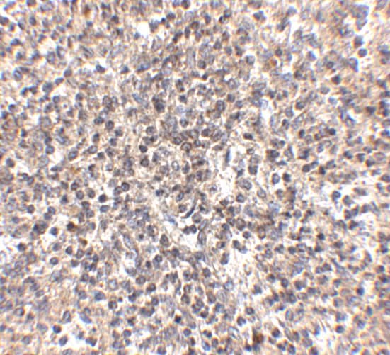 Immunohistochemistry: R-Spondin 1 Antibody - BSA Free [NBP1-77354] - Validation of R-Spondin 1 in Human Spleen Tissue. Immunohistochemical analysis of paraffin-embedded human spleen tissue using anti-R-Spondin 1 antibody  at 2.5 μg/ml. Tissue was fixed with formaldehyde and blocked with 10% serum for 1 h at RT; antigen retrieval was by heat mediation with a citrate buffer (pH6). Samples were incubated with primary antibody overnight at 4C. A goat anti-rabbit IgG H&L (HRP) at 1/250 was used as secondary. Counter stained with Hematoxylin.