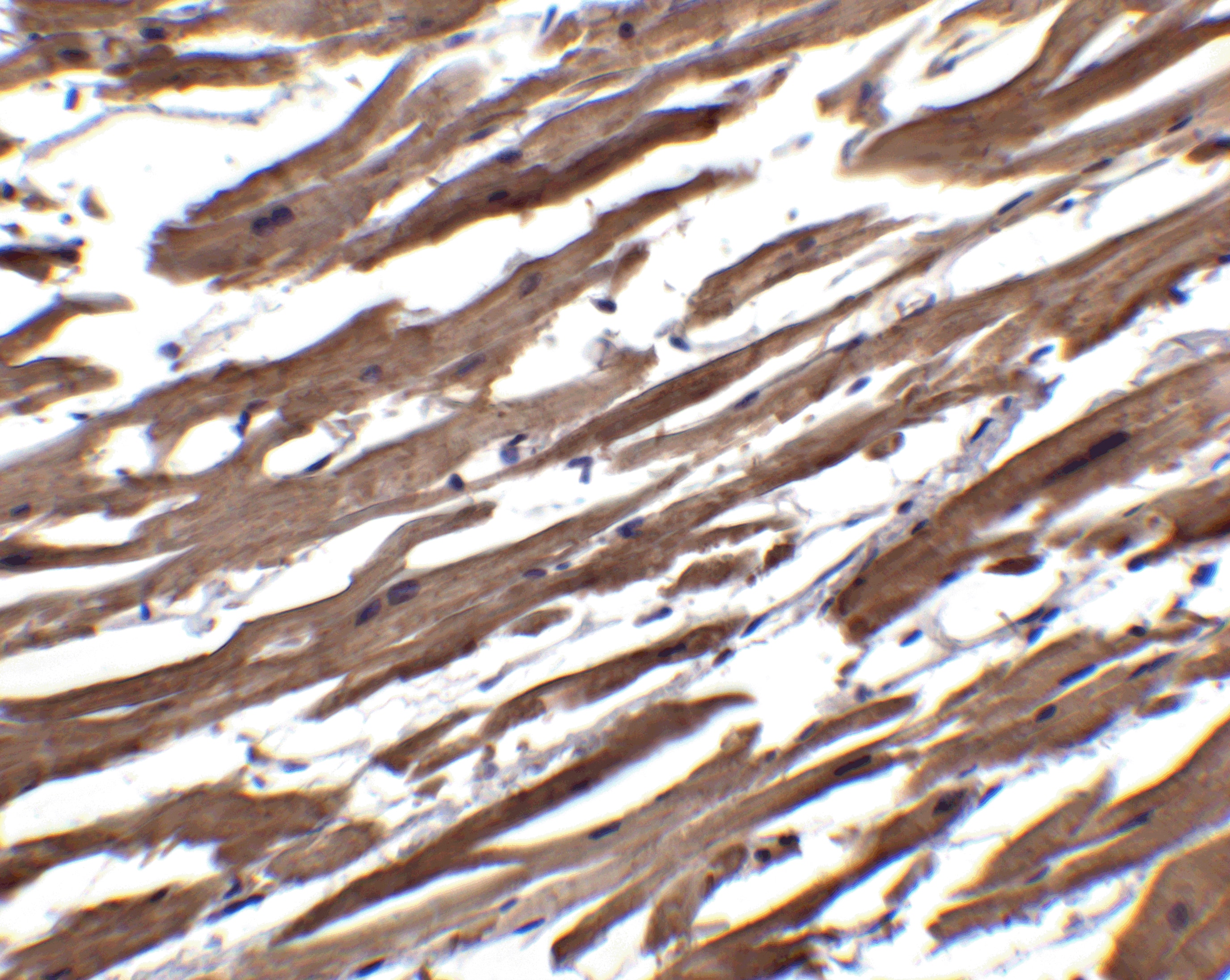 Immunohistochemistry: R-Spondin 1 Antibody - BSA Free [NBP1-77354] - Validation of R-Spondin 1 in Human Heart.   Immunohistochemical analysis of paraffin-embedded mouse spleen tissue using anti-R-Spondin 1 antibody  at 2.5 ug/ml. Tissue was fixed with formaldehyde and blocked with 10% serum for 1 h at RT; antigen retrieval was by heat mediation with a citrate buffer (pH6). Samples were incubated with primary antibody overnight at 4C. A goat anti-rabbit IgG H&L (HRP) at 1/250 was used as secondary. Counter stained with Hematoxylin.