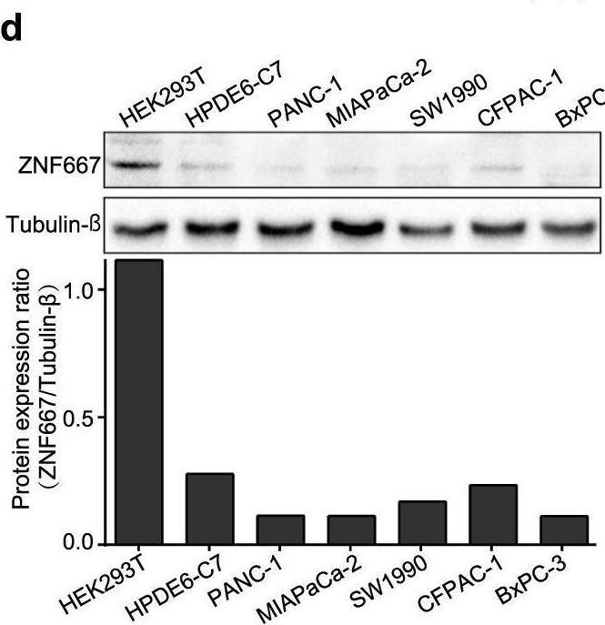 ZNF667 and ZNF667-AS1 as novel markers for prognosis in PDAC.a Immunohistochemistry of ZNF667 shows variations of abundance across patients using the tissue microarray analysis. b Overall survival and progression-free survival of self-collected PDAC patients grouped by the abundance of ZNF667. c Relative abundance of ZNF667 and ZNF667-AS1 to ACTB mRNA in normal pancreas cells (HPDE6-C7), human embryonic kidney cells (HEK293T), liver metastasis pancreas cancer cells (L3.7), and the pancreas cancer cells detected by RT-qPCR. All pancreas cancer cells showed a decreased level of ZNF667 and ZNF667-AS1. *P < 0.05; **P < 0.01. d Immunoblot showing the decreased abundance of ZNF667 in multiple pancreas cancer cell lines. The abundance was calculated at the bottom. e, f Validation of ZNF667 and ZNF667-AS1 overexpression (OE) in two pancreas cancer cell lines. **P < 0.01; ****P < 0.0001. g Immunoblot showing the abundance of ZNF667 in PANC-1 and SW1990 cells before and after overexpression. h, i Proliferation evaluation (CCK8-positive cell ratio) after ZNF667 and ZNF667-AS1 overexpression in two pancreas cancer cell lines. n = 3 for each time point. **P < 0.001; ****P < 0.00001. j Evaluation of cellular apoptosis after ZNF667-AS1 overexpression in two pancreas cancer cell lines. n.s., no significance. Image collected and cropped by CiteAb from the following open publication (//pubmed.ncbi.nlm.nih.gov/35165277), licensed under a CC-BY license. Not internally tested by Novus Biologicals.
