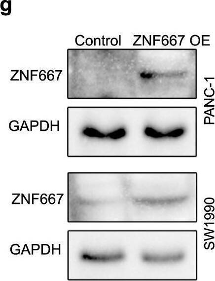 ZNF667 and ZNF667-AS1 as novel markers for prognosis in PDAC.a Immunohistochemistry of ZNF667 shows variations of abundance across patients using the tissue microarray analysis. b Overall survival and progression-free survival of self-collected PDAC patients grouped by the abundance of ZNF667. c Relative abundance of ZNF667 and ZNF667-AS1 to ACTB mRNA in normal pancreas cells (HPDE6-C7), human embryonic kidney cells (HEK293T), liver metastasis pancreas cancer cells (L3.7), and the pancreas cancer cells detected by RT-qPCR. All pancreas cancer cells showed a decreased level of ZNF667 and ZNF667-AS1. *P < 0.05; **P < 0.01. d Immunoblot showing the decreased abundance of ZNF667 in multiple pancreas cancer cell lines. The abundance was calculated at the bottom. e, f Validation of ZNF667 and ZNF667-AS1 overexpression (OE) in two pancreas cancer cell lines. **P < 0.01; ****P < 0.0001. g Immunoblot showing the abundance of ZNF667 in PANC-1 and SW1990 cells before and after overexpression. h, i Proliferation evaluation (CCK8-positive cell ratio) after ZNF667 and ZNF667-AS1 overexpression in two pancreas cancer cell lines. n = 3 for each time point. **P < 0.001; ****P < 0.00001. j Evaluation of cellular apoptosis after ZNF667-AS1 overexpression in two pancreas cancer cell lines. n.s., no significance. Image collected and cropped by CiteAb from the following open publication (//pubmed.ncbi.nlm.nih.gov/35165277), licensed under a CC-BY license. Not internally tested by Novus Biologicals.