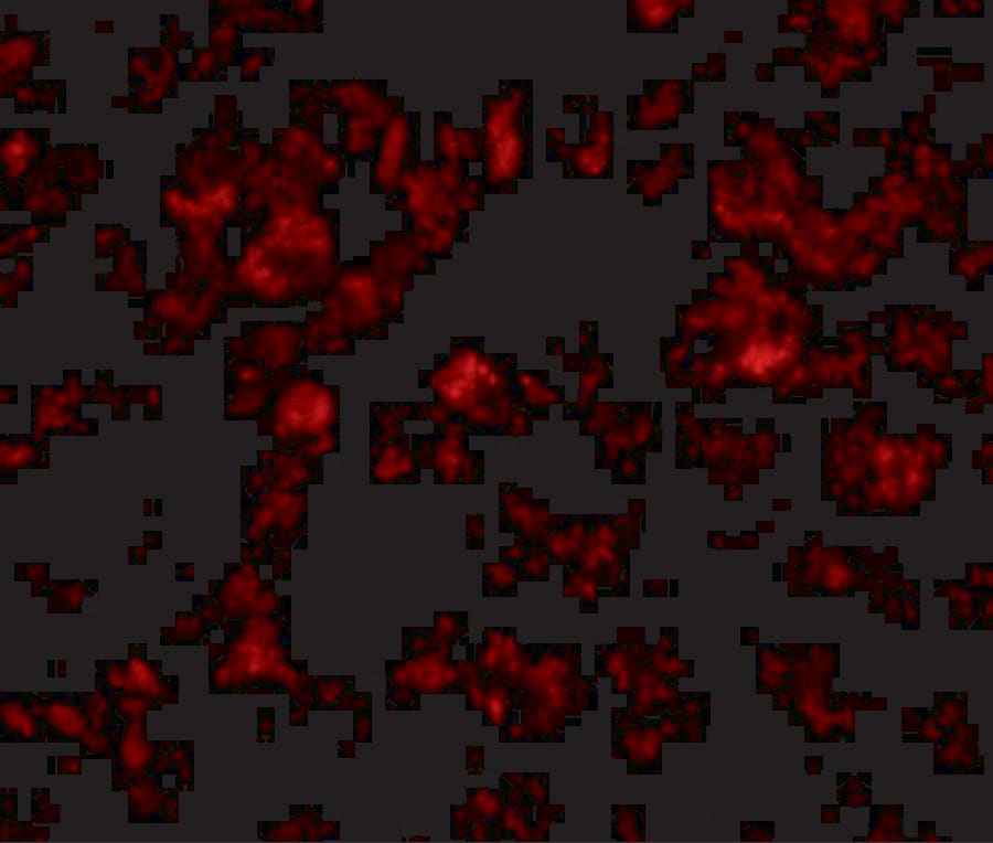 Immunocytochemistry/ Immunofluorescence THEM4 Antibody - BSA Free