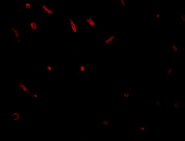 Immunocytochemistry/ Immunofluorescence: TWA1 Antibody - BSA Free [NBP1-77366] - Immunofluorescence of TWA1 in rat brain tissue with TWA1 antibody at 20 u/mL.