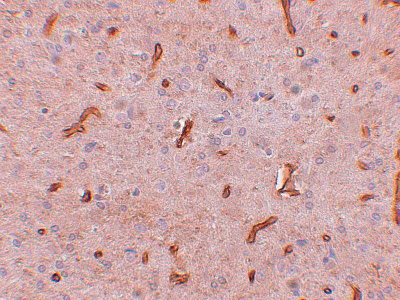 Immunohistochemistry: TWA1 Antibody - BSA Free [NBP1-77366] - Immunohistochemistry of TWA1 in rat brain tissue with TWA1 antibody at 2.5 u/mL. 