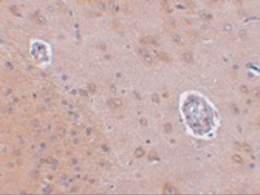 Immunohistochemistry FAM120A Antibody - BSA Free