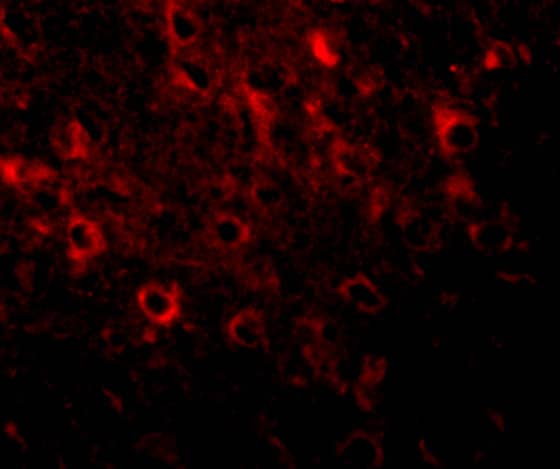 Immunocytochemistry/ Immunofluorescence FAM120A Antibody - BSA Free