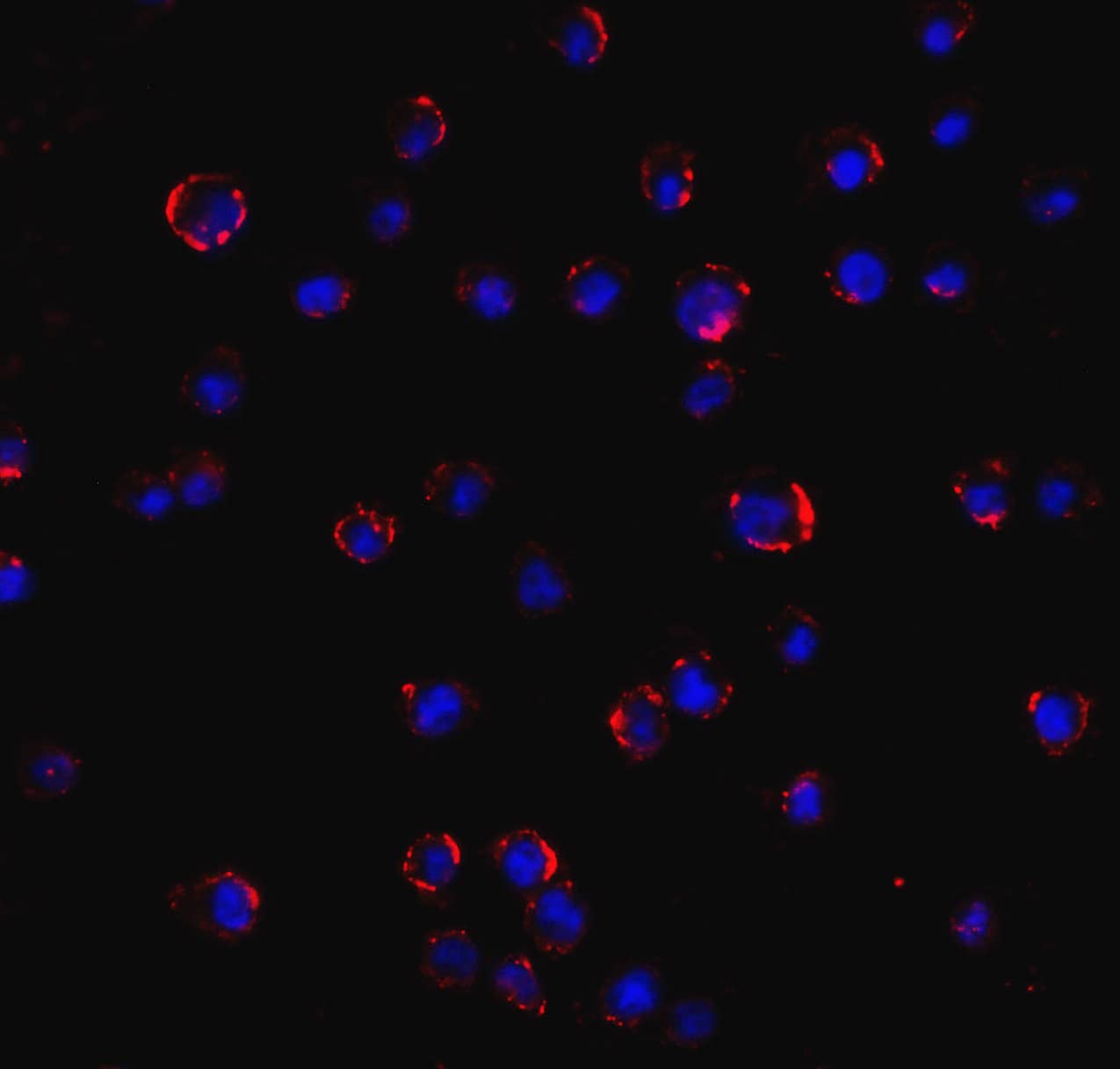 Immunocytochemistry/ Immunofluorescence: AGTR-2 Antibody - BSA Free [NBP1-77368] - Immunofluorescence of AGTR-2 in Jurkat cell with AGTR-2 Antibody at 5 ug/ml.